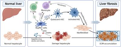 Immunomodulatory role of mesenchymal stem cell therapy in liver fibrosis